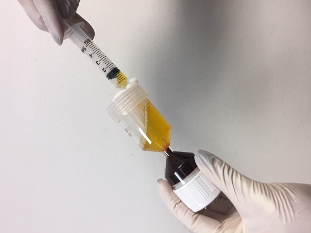 World PRP - Plasma (Option 3)